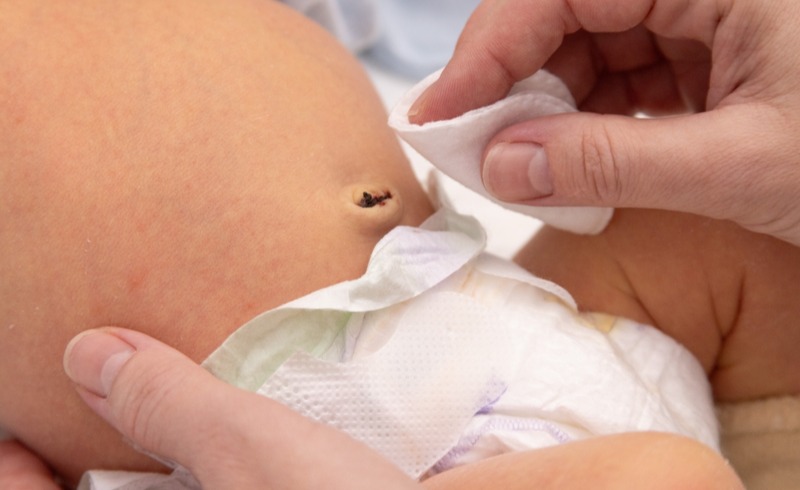 Göbek Bağı Ne Zaman Düşer?